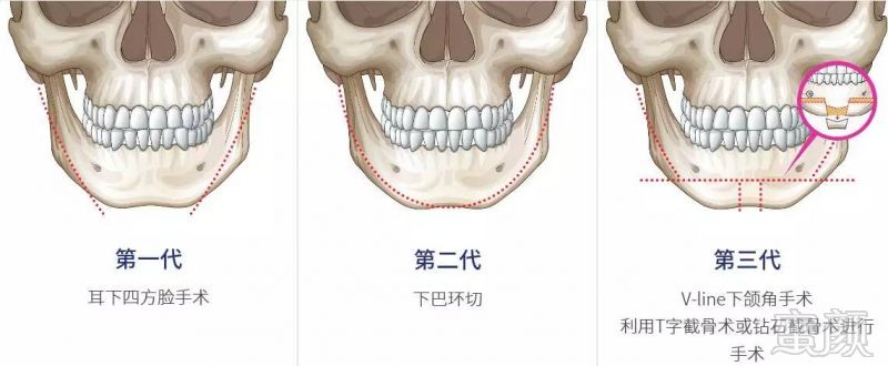 https://img.miyanlife.com/timg/170426/232105H28-1.jpg