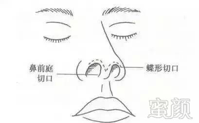 https://img.miyanlife.com/timg/170428/144UG937-5.jpg