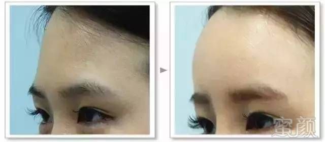 https://img.miyanlife.com/timg/170428/1542494C3-8.jpg