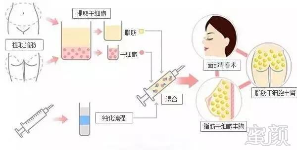 https://img.miyanlife.com/timg/170428/1542501S5-13.jpg