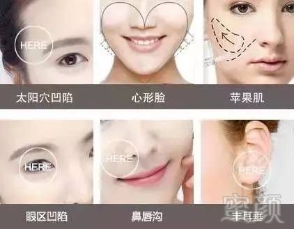 https://img.miyanlife.com/timg/170429/22051Q159-14.jpg