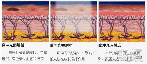 案例图片