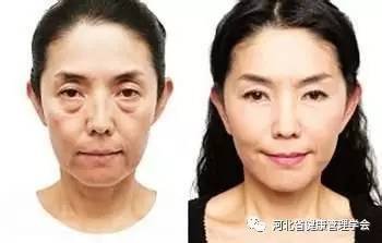 案例图片
