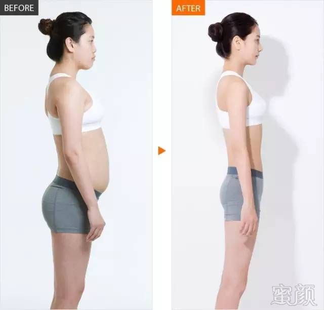 案例图片
