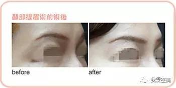 https://img.miyanlife.com/timg/170502/2322592R0-4.jpg