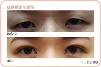 https://img.miyanlife.com/timg/170502/23225S036-2.jpg