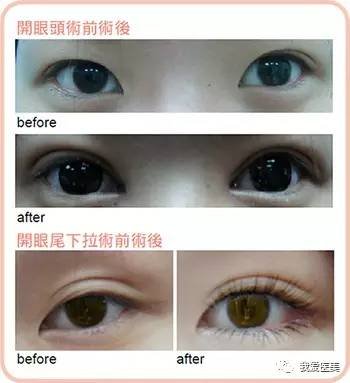 https://img.miyanlife.com/timg/170502/23225UQ5-1.jpg