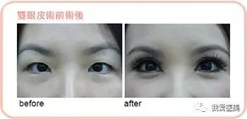 https://img.miyanlife.com/timg/170502/23225VS1-3.jpg