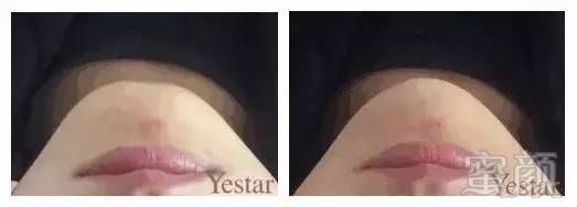 https://img.miyanlife.com/timg/170503/220Qa092-7.jpg 案例图片