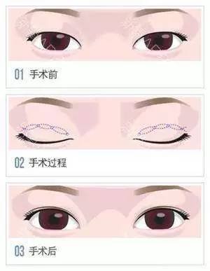 https://img.miyanlife.com/timg/170503/23102260W-7.jpg