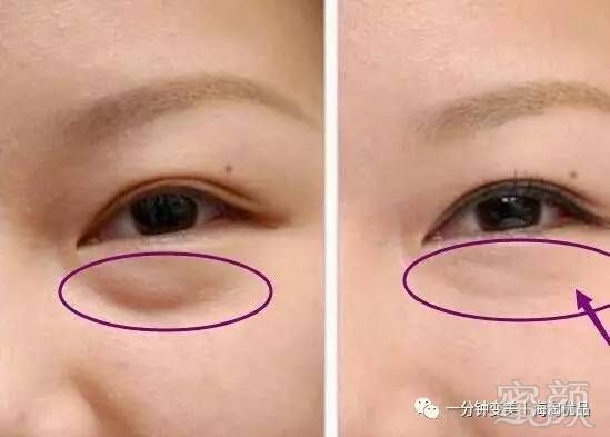 https://img.miyanlife.com/timg/170504/0030032329-0.jpg
