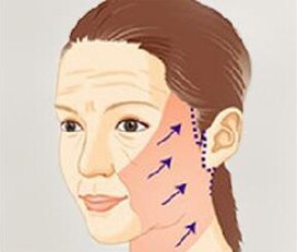 https://img.miyanlife.com/timg/170504/1F22R115-11.jpg