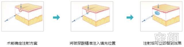 案例图片