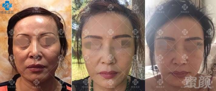 https://img.miyanlife.com/timg/170504/21043WF2-2.jpg