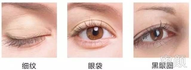 https://img.miyanlife.com/timg/170506/0511341007-2.jpg